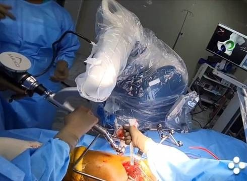 Best Robotic Surgeon for Hip Pain Treatment in Gurugram