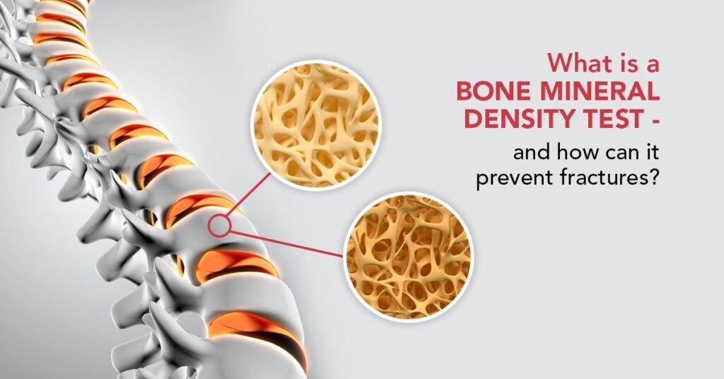 Best Bone Mineral Density in Sector 51, Gurugram