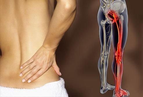 Best Sciatica treatment in Gurugram Sector 57