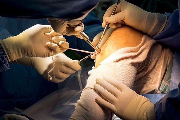 Best Arthroscopy Surgeon in Gurgaon