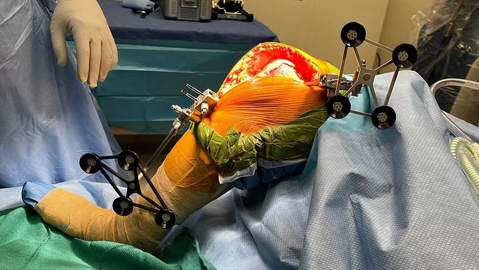 Robotic Knee Replacement Surgeon in Gurugram