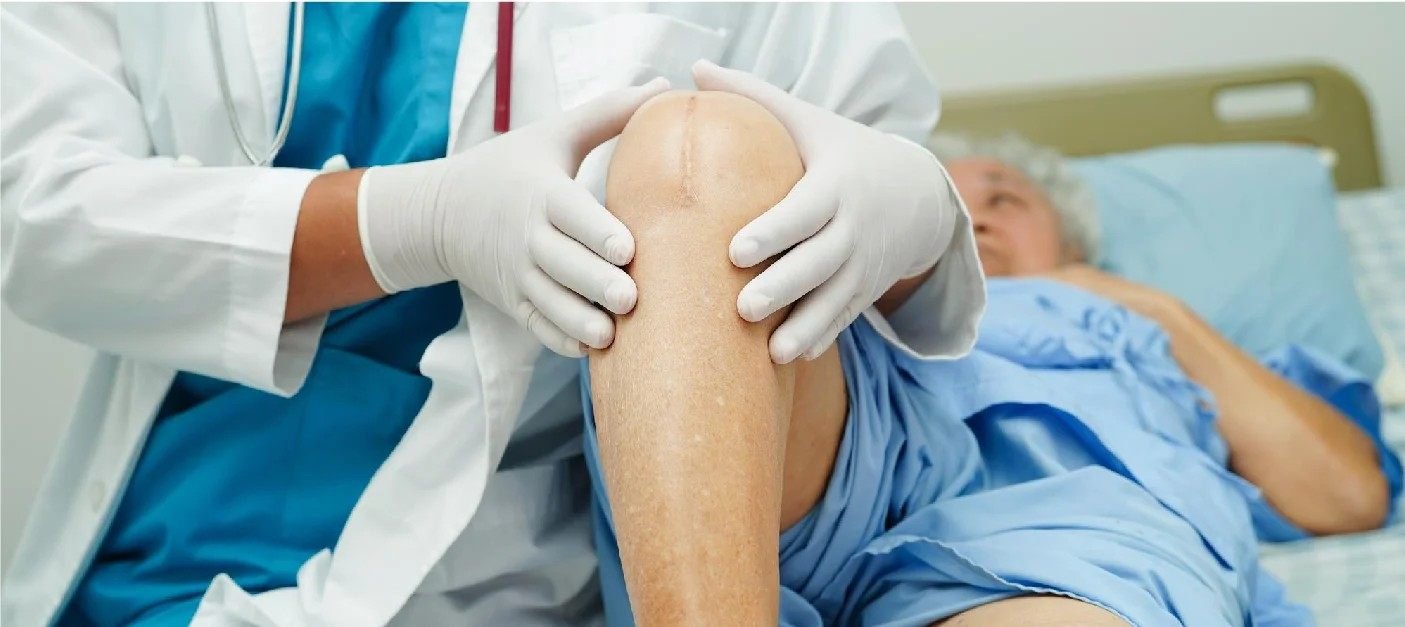 Knee Replacement Doctor in Sector 51 Gurgaon