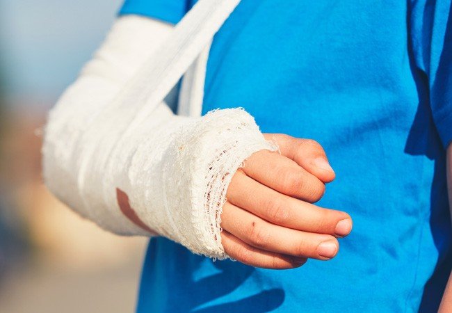 Fracture Treatment in Sector 51 Gurugram