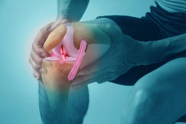 A man suffered a serious knee injury after suffering anterior cruciate ligament tear in a sports accident.