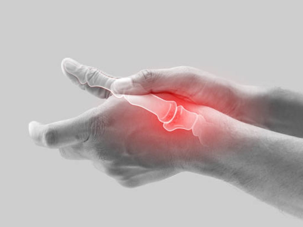 Arthritis of the finger and thumb joint.
