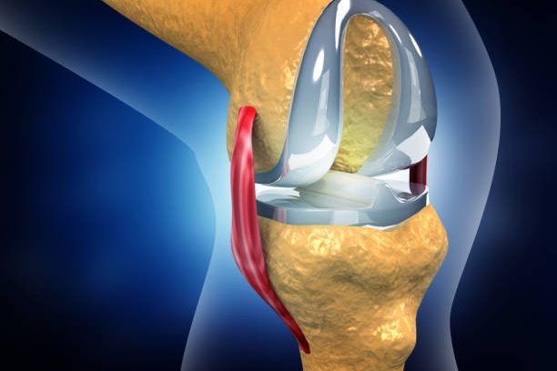Human knee replacement implant. 3d illustration